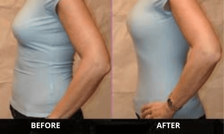 Before and after posture photo