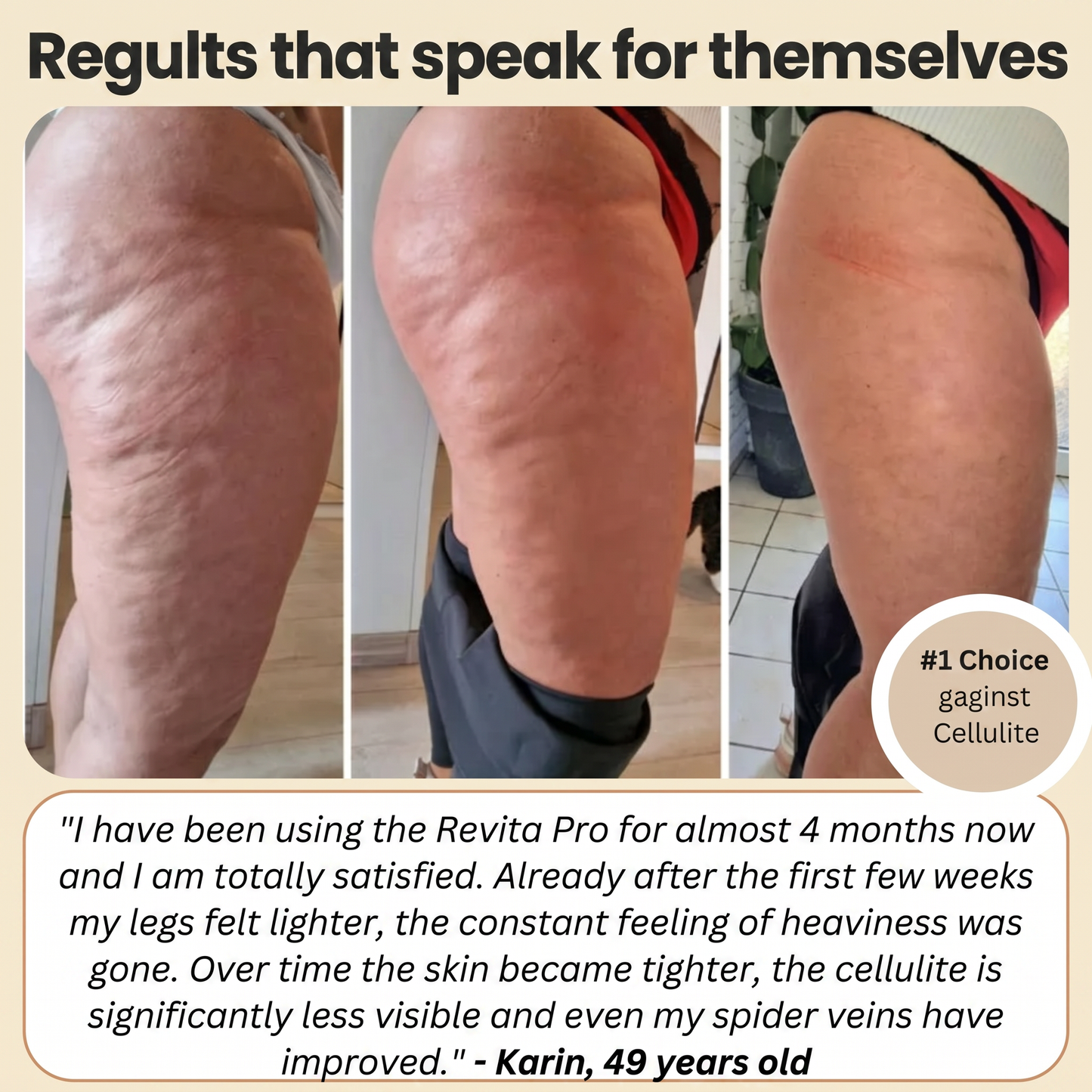 FEMILLIE PRO – Compression Leggings with a Calorie-Burning Effect and Skin-Firming Benefits
